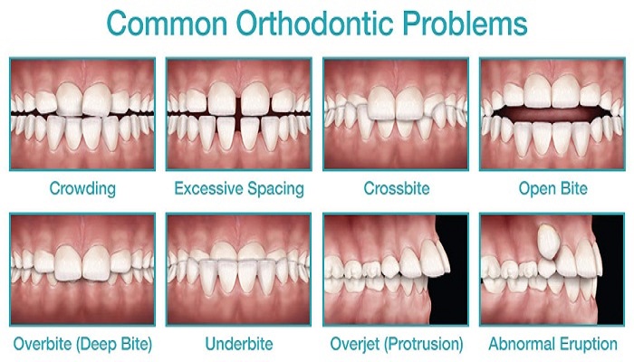 Common Problems2