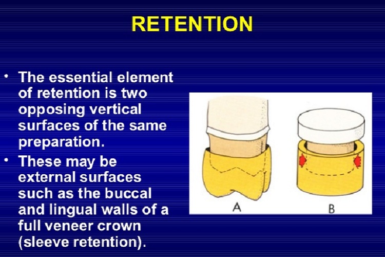 Retention3