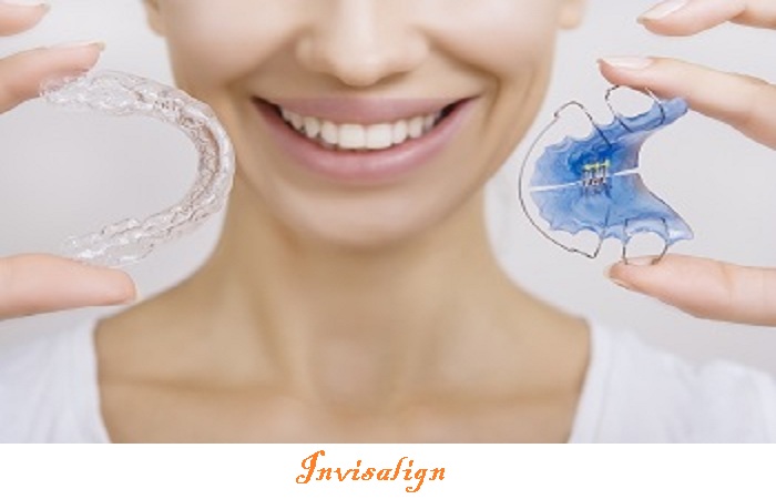 Invisalign